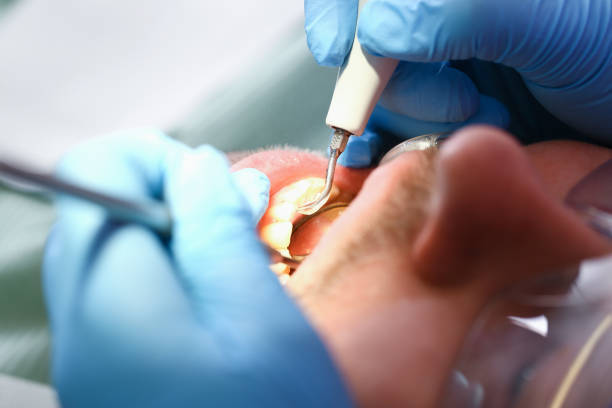 Best Urgent Care for Lost Fillings or Crowns in Powell, AL
