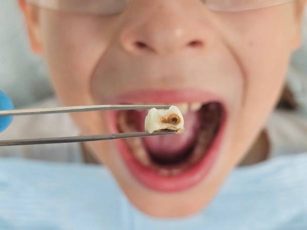 Best After-Hours Dental Trauma Care in Powell, AL